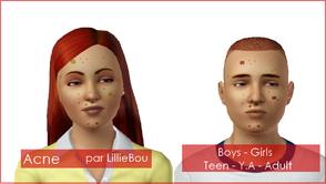 Sims 3 —  by lilliebou — Don't try to hide your acne anymore. It's part of you! You can find this in Create a Sim,