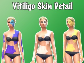 Sims 4 — Vitiligo Skin Detail by Eenhoorntje — It's a stand-alone recolor with 14 swatches. I made the colorful swatches