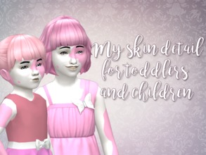 Sims 4 — Birthmarks for toddlers and children by Eenhoorntje — A year ago, I made a new skindetail. I decided to make it