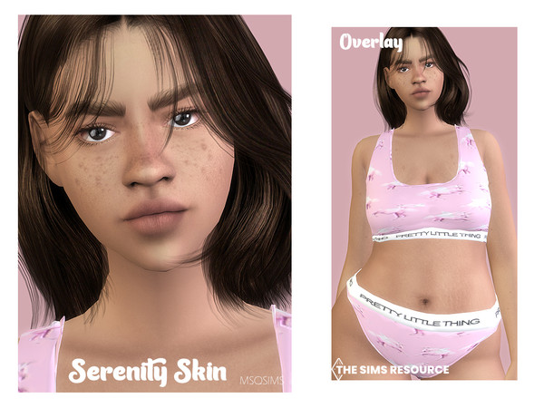 Sims 4 — Serenity Skin Overlay by MSQSIMS — This imperfect skin overlay with stretch marks, freckles and acne comes in 4