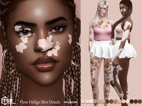 Sims 4 — Flora Vitiligo Skin Details by MSQSIMS — These Vitiligo Skin Details comes in full body in 2 different versions